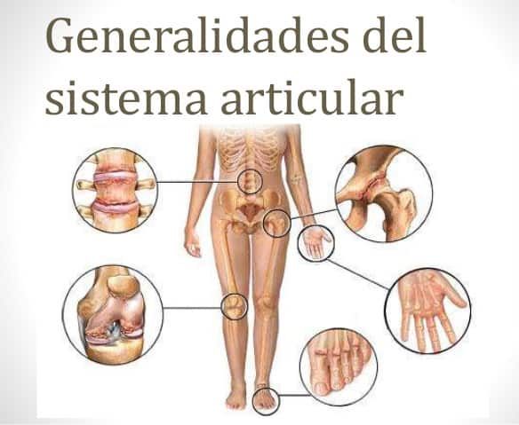 Sistema articular