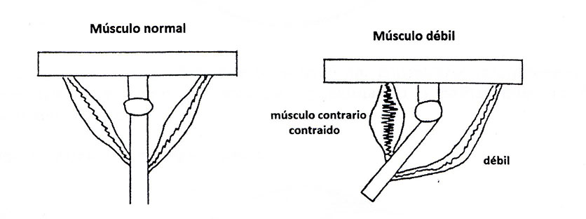 Kine-1-Musculo-normal
